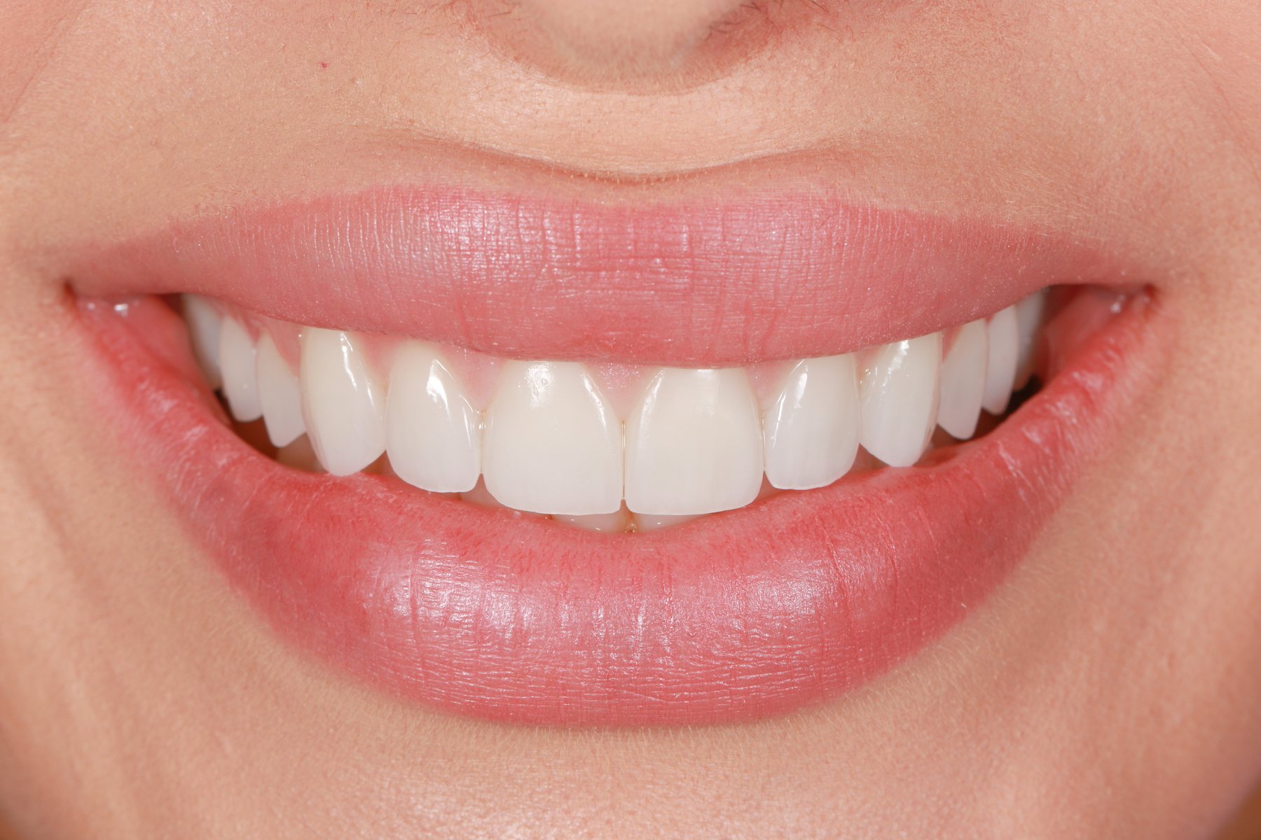 Delivered smile · veneer aesthetics