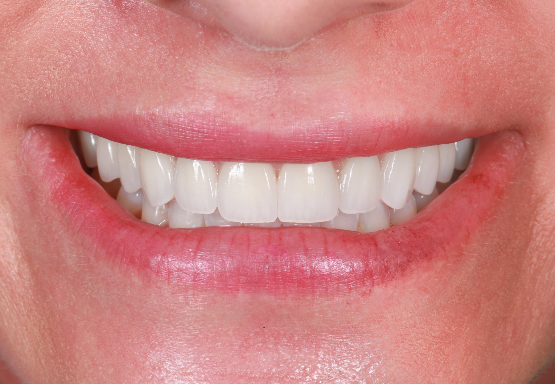 Delivered smile · contour & shade